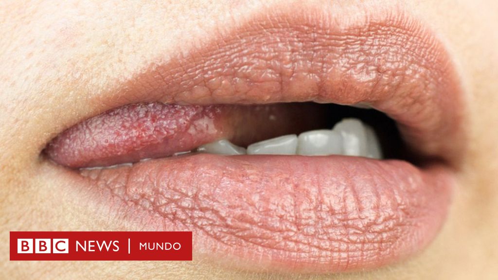 ENFERMEDADES DE TRANSMISION SEXUALIDAD EN LA BOCA ️ Mentalidad Humana